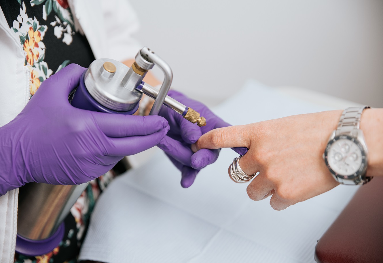 Cryothérapie – s/groupe-effiscience–infirmier/sg/img4e.jpg