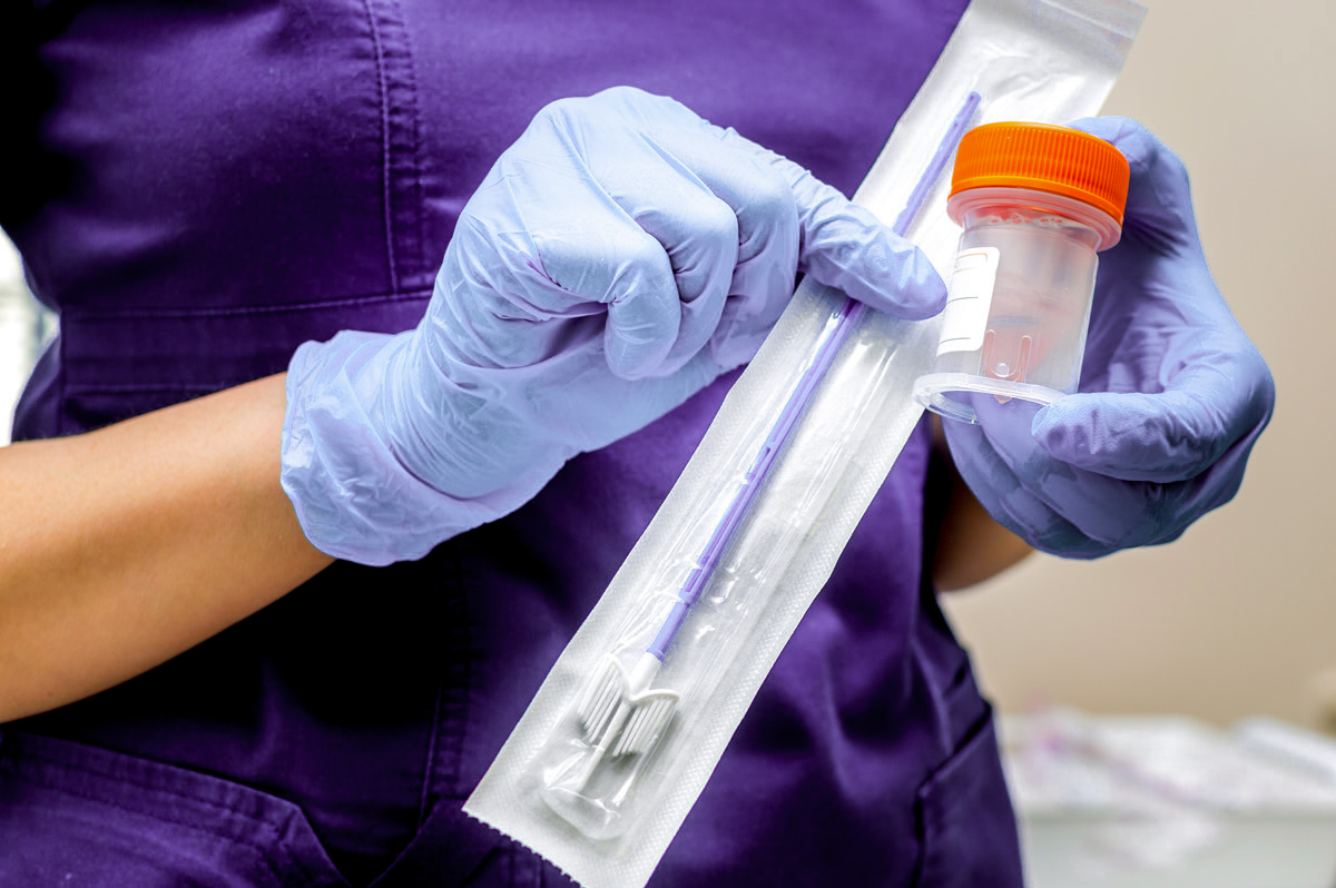 Dépistage d&rsquo;ITSS – /s/groupe-effiscience–infirmier/ss/cervical-screening-image-2.jpg