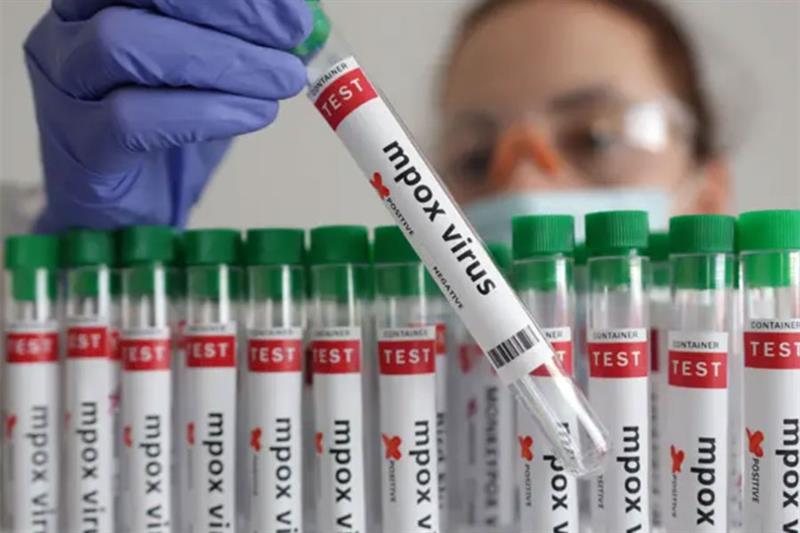 Mpox (Variole Simienne) : Quels Sont les Risques et Comment se Protéger ?